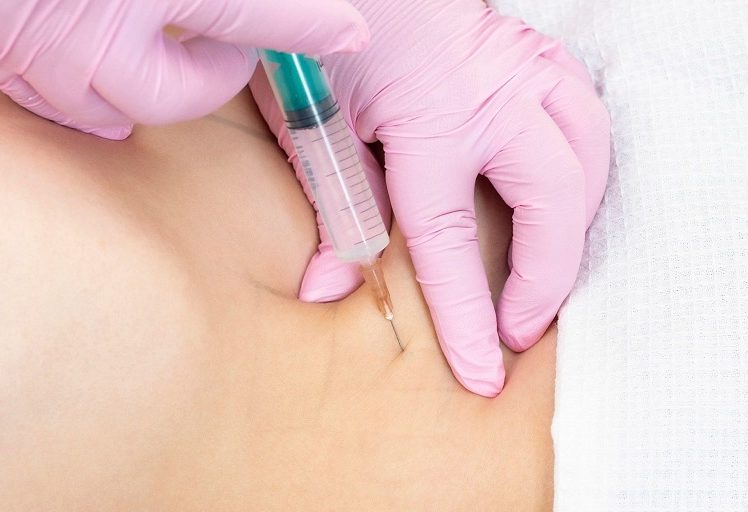 Липолитики