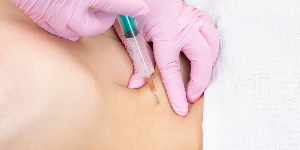 Липолитики